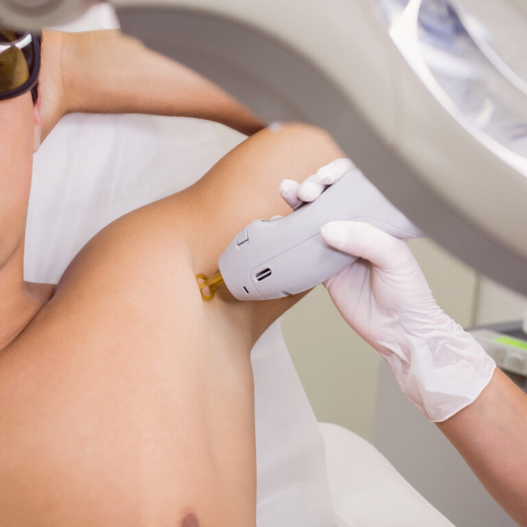 Doctor performing laser hair removal on male patient skin in clinic